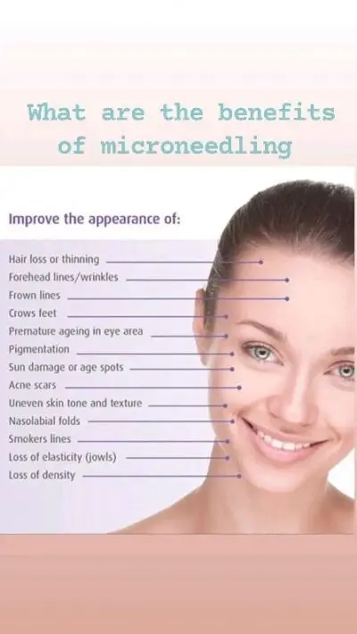 Medical MicroneedlingUsing the AmieaMed Exceed ❤️

Microneedling Facial facialcream skincareregime skincare skincarenorthernireland skincareroutine skincareroutines retinolserum serum collagenbooster collagen collagenproduction scarrepair derry londonderry northernireland ireland